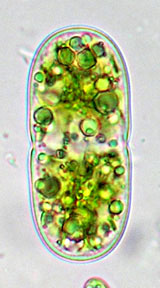 Actinotaenium americanum